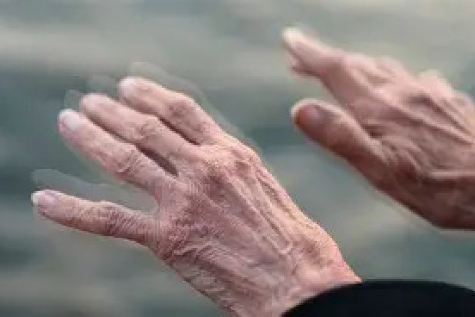 parkinson